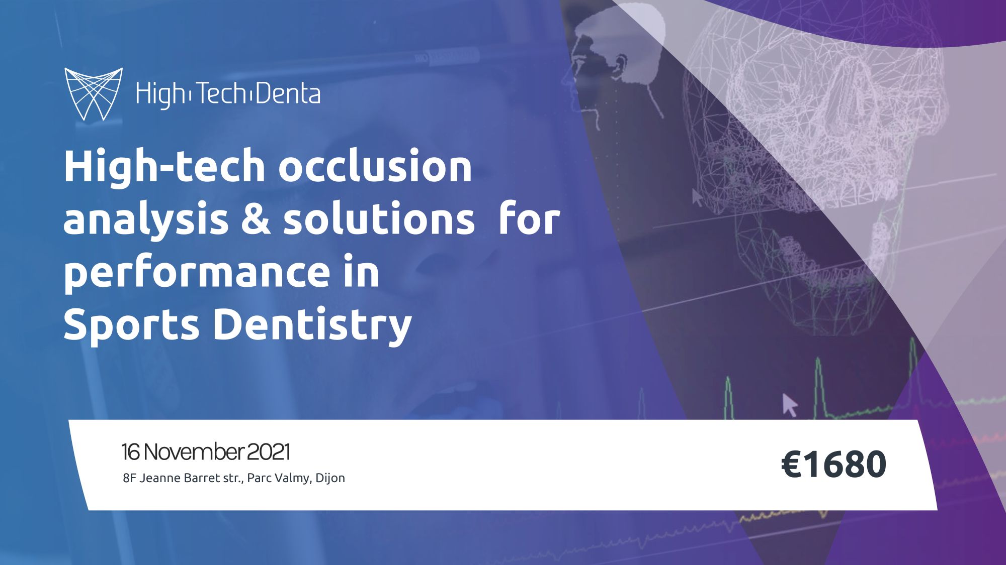 http://HIGH-TECH%20OCCLUSION%20ANALYSIS%20&%20SOLUTIONS%20FOR%20PERFORMANCE%20IN%20SPORT%20DENTISTRY